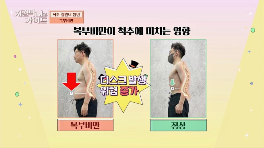 복부비만과 흡연, 허리 통증 악화 원인 관련 이미지