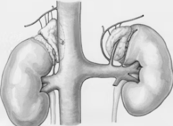 신장이 안좋으면 나타나는 증상