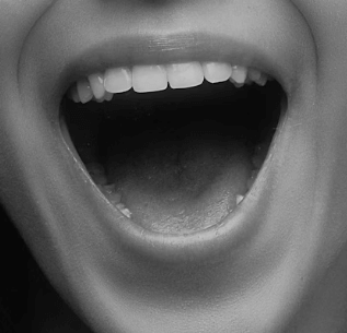 편도결석 빼는 법 - 개요