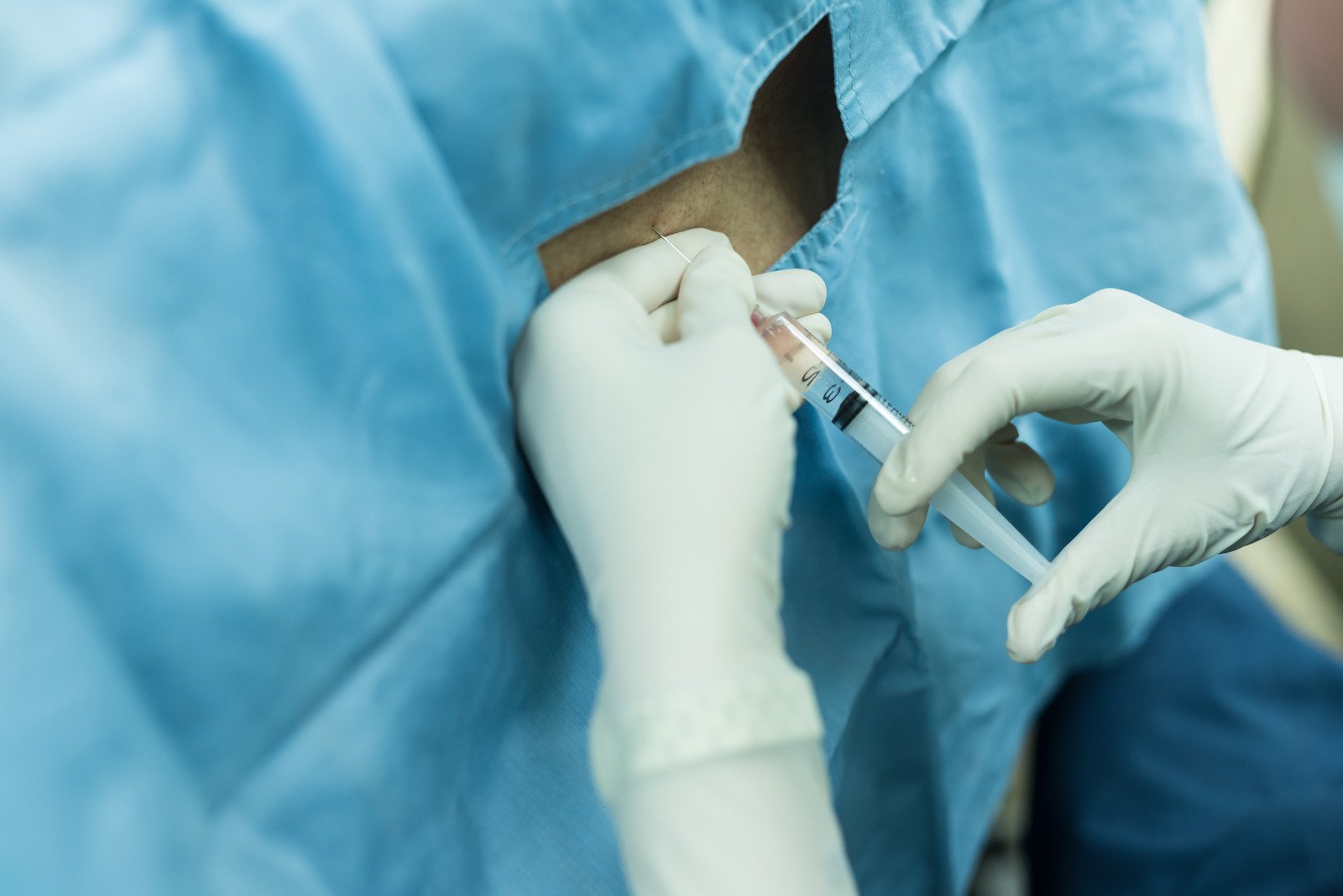 신경 차단술 주사