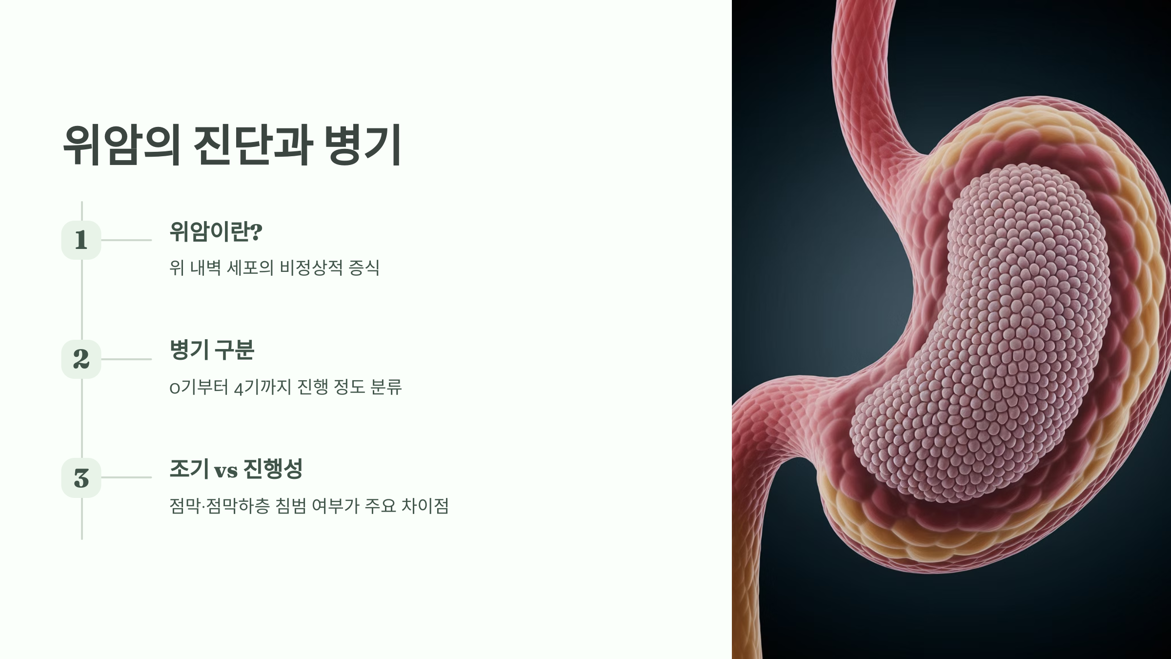 위암의 진단과 병기