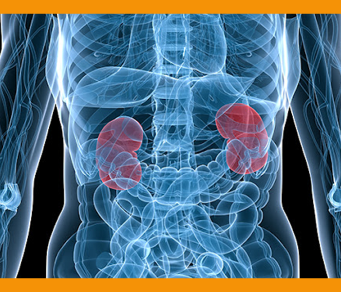 오른쪽 옆구리 통증 원인 - 신우신염