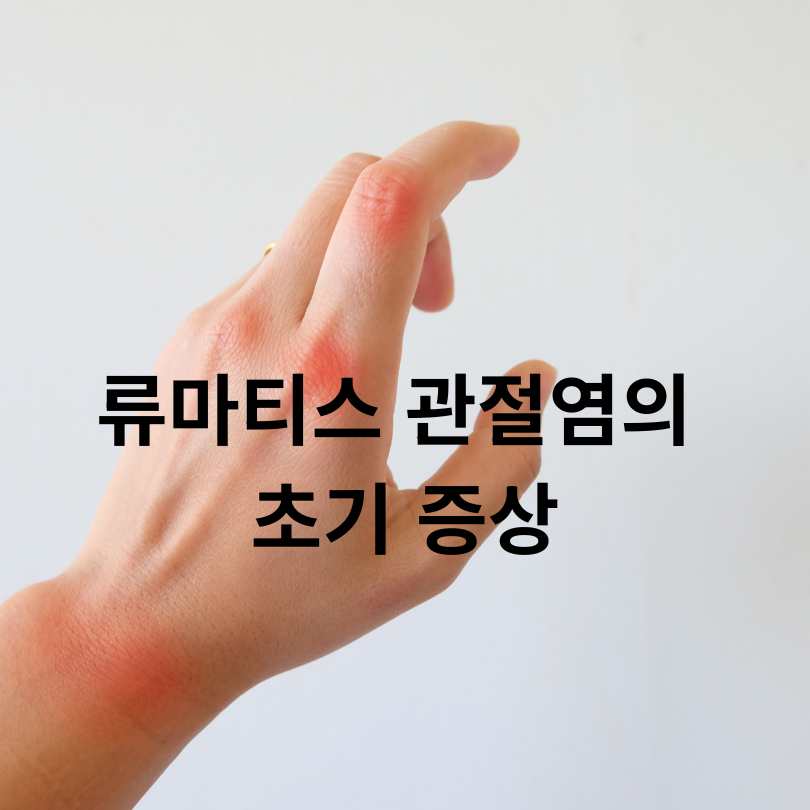 류마티스 관절염 진단법 총정리! 정확한 검사방법과 초기 대처법