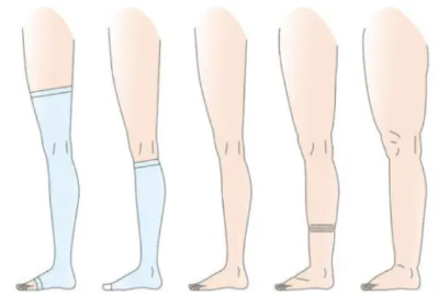 붓기 해소법 13선