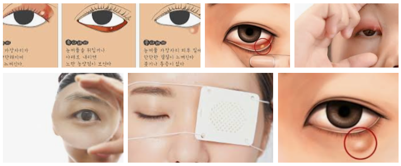 눈다리깨의 진실