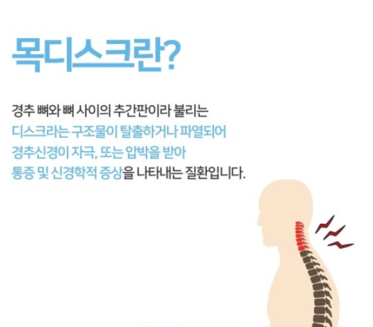 목-디스크