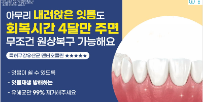 잇몸 재생 덴티오클린 효과 후기