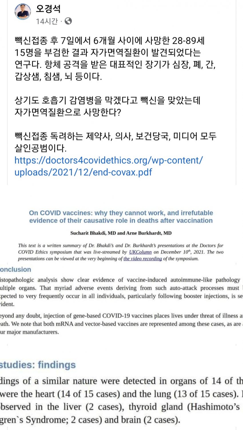 백신 접종 후 자가면역질환사망