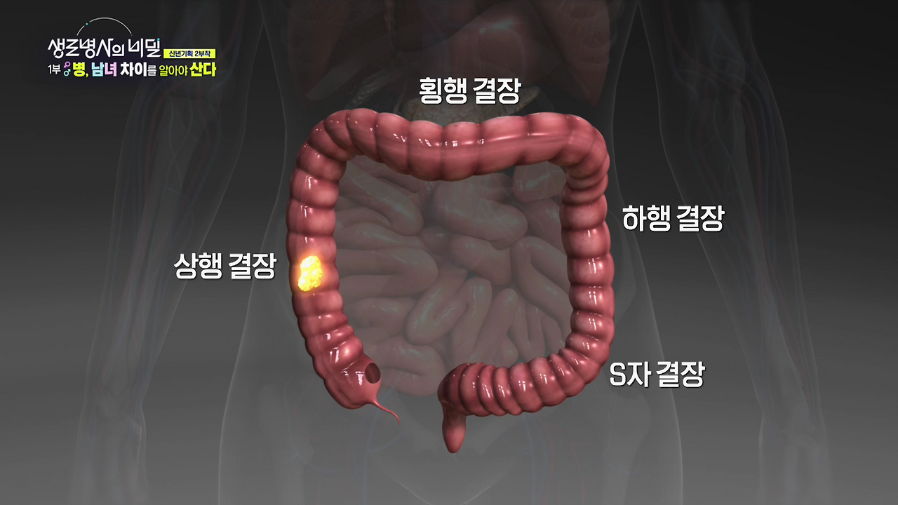 생로병사의 비밀 남녀 성차의학