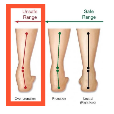 족저근막염-신발