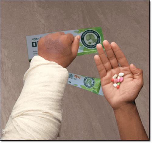 고투콜라 상처 치료 효과