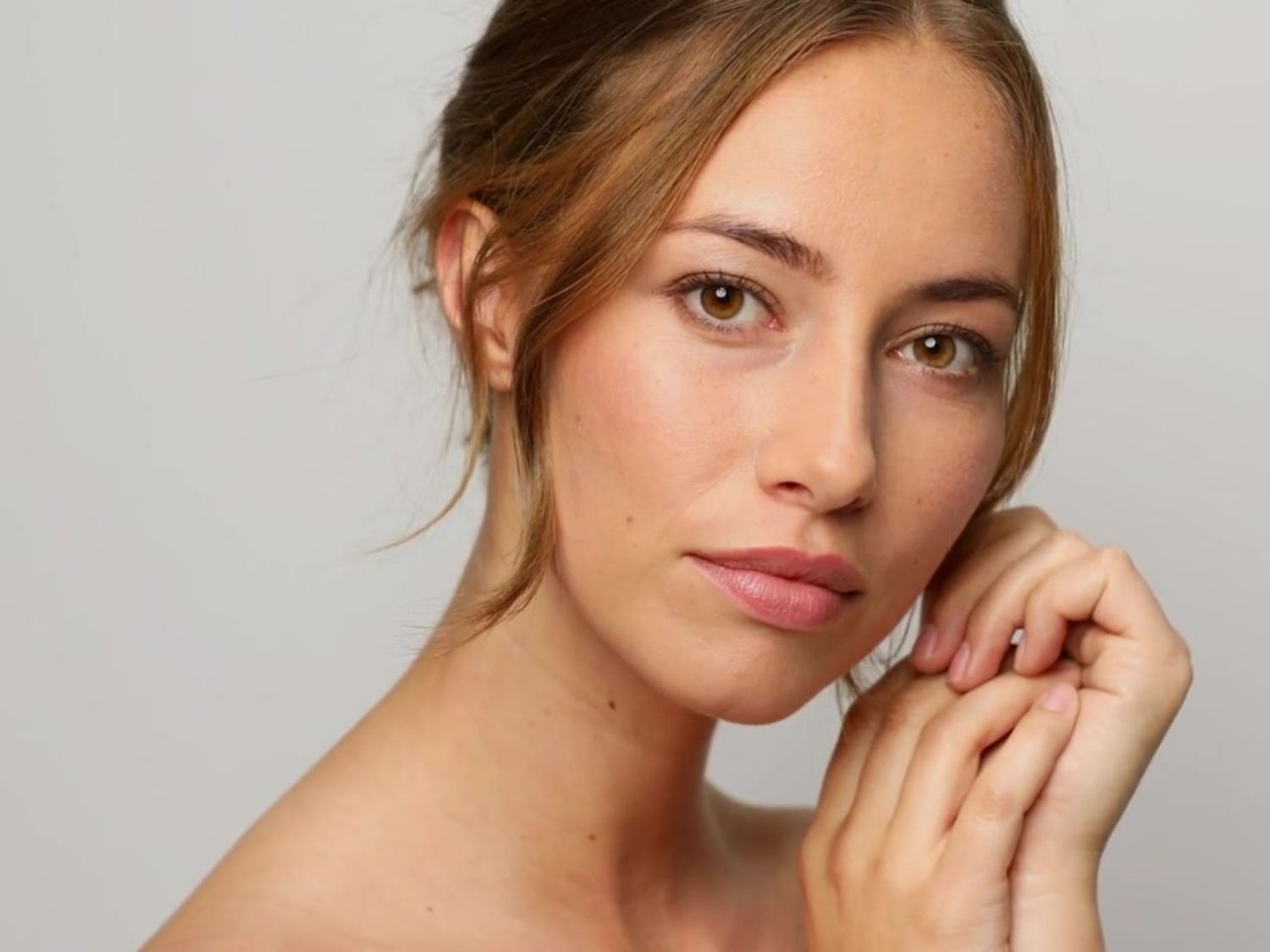 안면거상술 스마스층