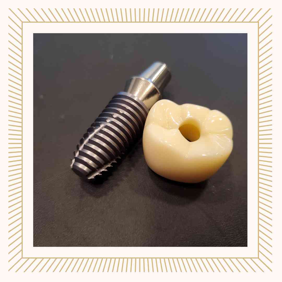 임플란트 건강보험