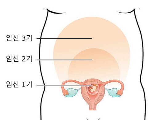 의학용어 afterpain 뜻 후진통, 훗배앓이