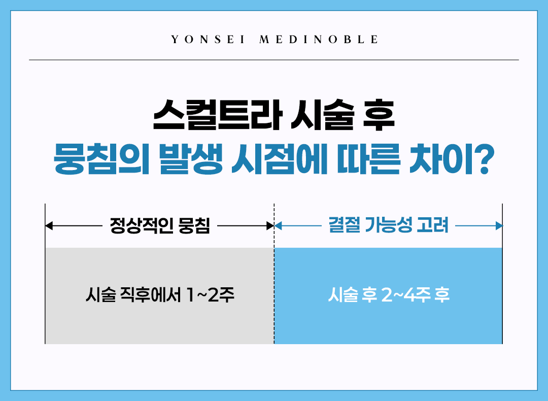 스컬트라 결절 발생 시기별 구분 타임라인