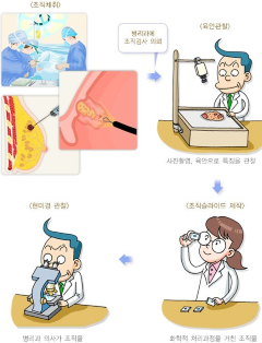 조직 검사 일러스트