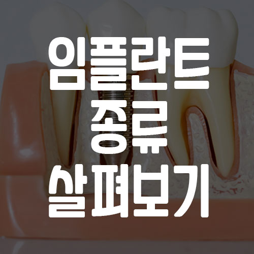 임플란트 종류 및 브랜드