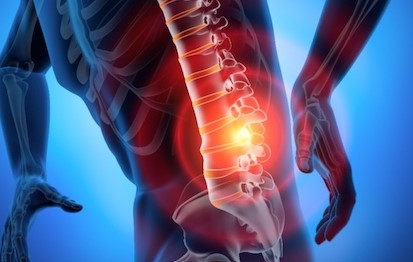 허리 디스크가 발생하여 아픈 통증의 위치를 표현한 사진