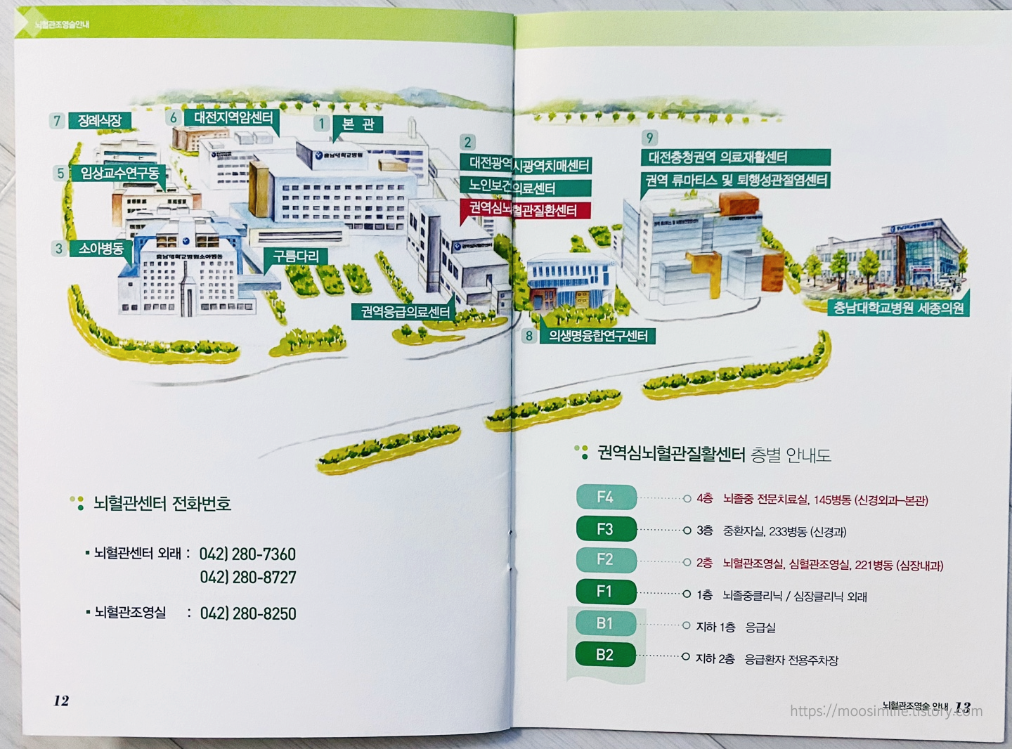 뇌동맥류-뇌혈관조영술-입원