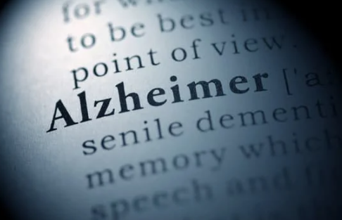 알츠하이머 초기증상 4가지와 대처방법 알아보기