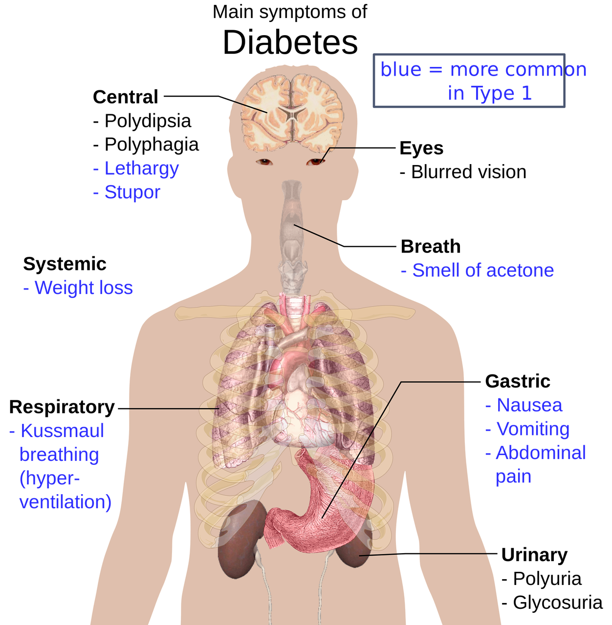 칼륨의 중요성 : 저칼륨혈증의 신호와 예방법