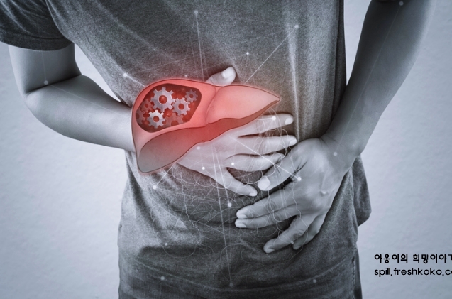 간수치가 높으면 나타나는 증상