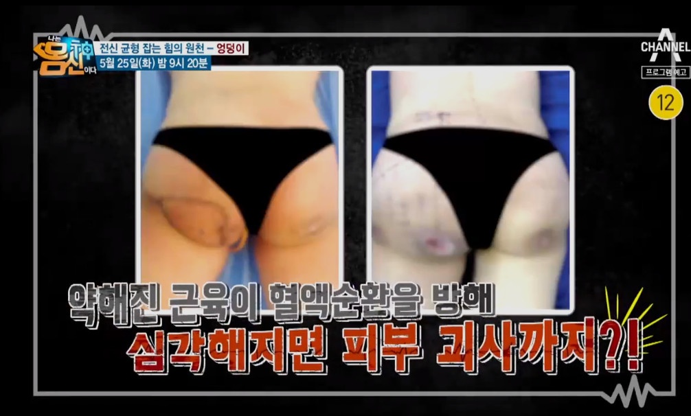 나는 몸신이다 엉덩이 333회 재방송 다시보기 210525 애플힙 힙업 밴드