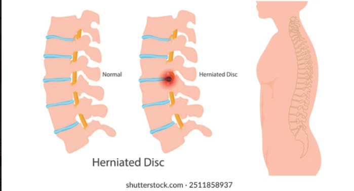 왼쪽 오른쪽 옆구리 통증 원인 5가지와 찌릿한 증상별 대처법 총정리