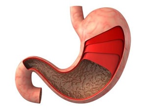 급성 위경련 증상 원인 치료 방법