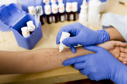 알레르기 검사.