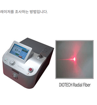 다리가-붓는-이유-하지정맥류-수술비용