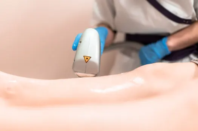 하지정맥류 초기 증상과 원인 치료방법