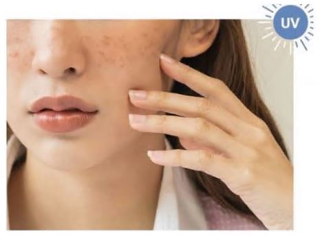 도미나크림-효능