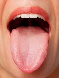 설암_원인_증상_치료방법