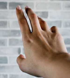 손가락 마디 통증 원인과 치료방법|언제 병원에 가야 할까?