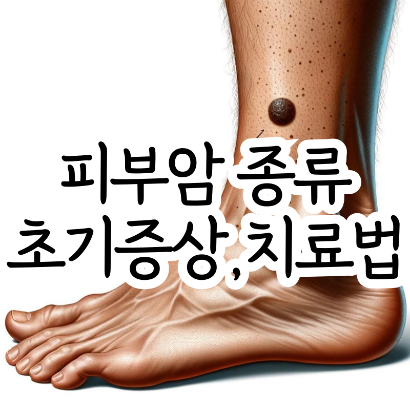 피부암 초기 증상 종류 치료법