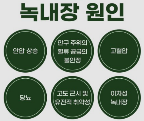 녹내장 원인