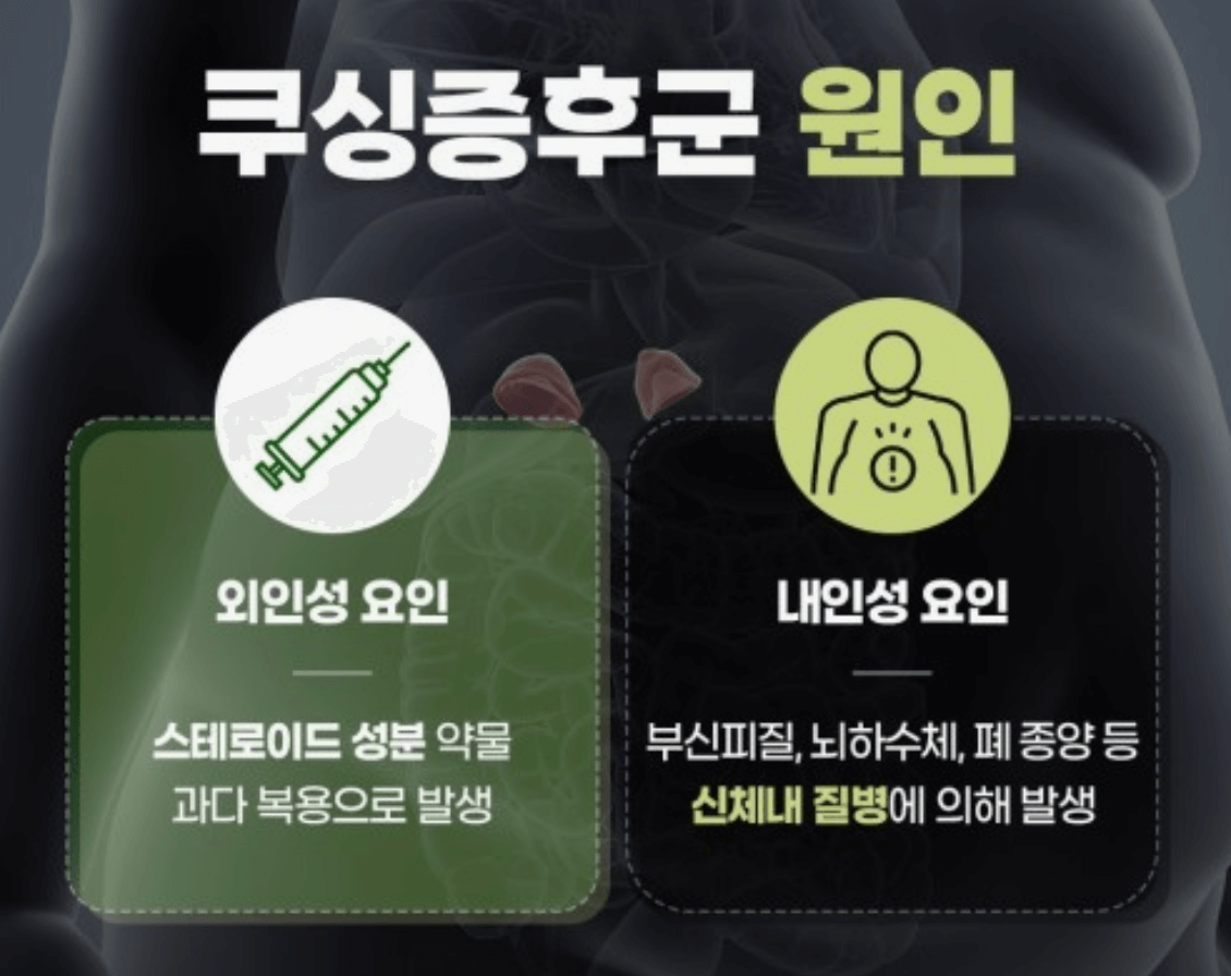 쿠싱증후군 원인