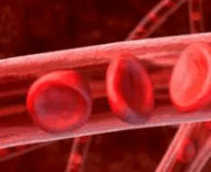 심혈관질환예방