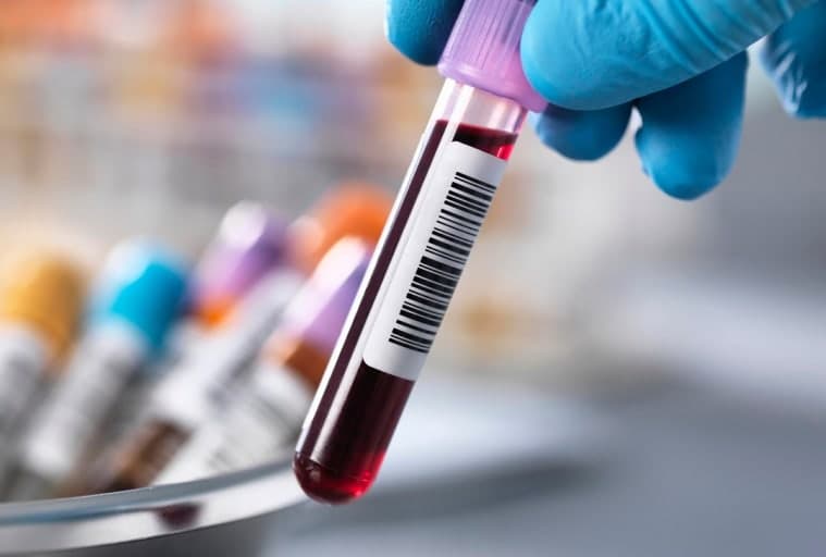 신규 간호사를 위한 혈액검사 결과 보는 법: 기본 수치 쉽게 정리하기