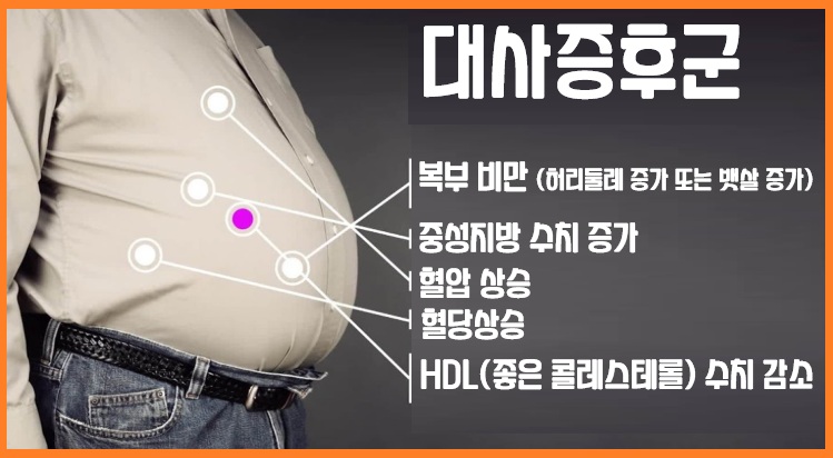 대사증후군