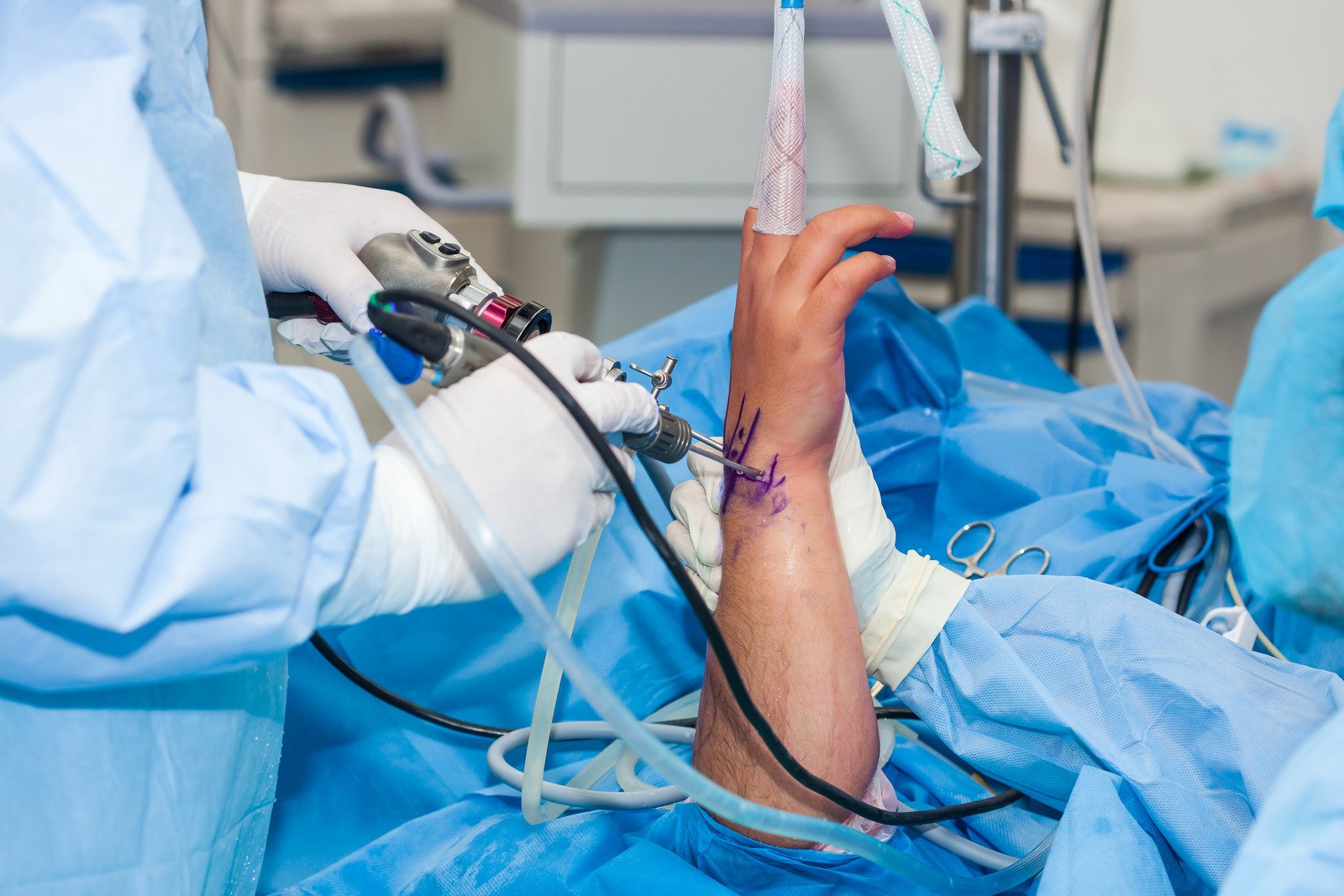 손목 관절경 수술