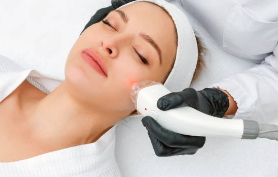 검버섯 레이저 치료