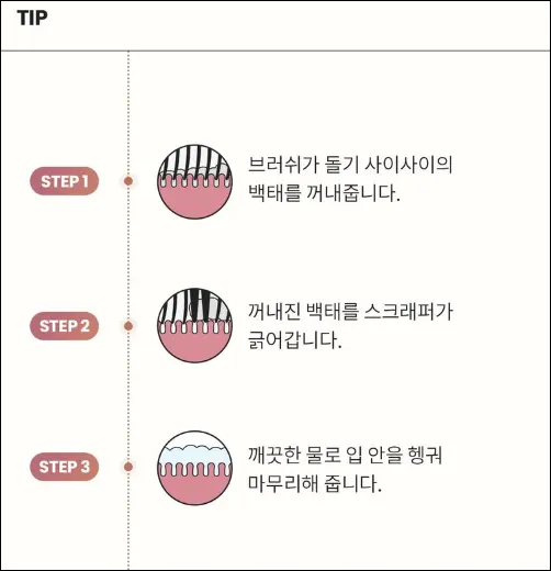 입냄새제거, 혀클리너