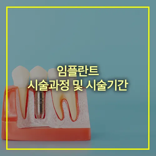 임플란트 시술과정 시술기간