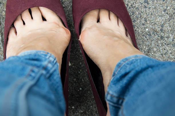 티눈 생기는 이유&amp;#44; 굳은살과 사마귀 차이 및 치료에 대해 알아봤습니다. 한번쯤은 손과 발에 티눈이 발생하는 것을 볼 수 있습니다. 티눈이 생기는 이유와 굳은살&amp;#44; 사마귀 차이점&amp;#44; 치료법&amp;#44; 티눈약 부작용 및 주의사항도 참고하시기 바랍니다. 