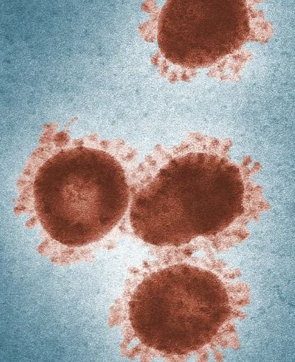 인유두종 바이러스 증상