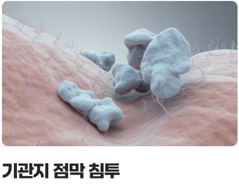 &amp;#39;도라지&amp;#39; - 기관지의 천연 청소부