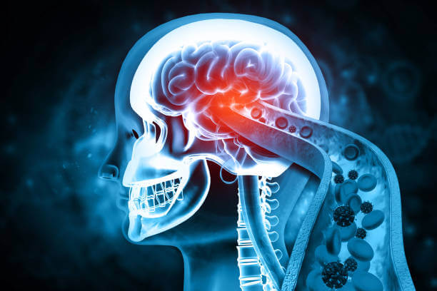 뇌전증 전조증상, 원인과 진단 내용입니다. 뇌전증은 예상치 못한 증상과 고통을 야기할 수 있습니다. 이 블로그 글에서는 뇌전증의 전조증상에 대해 알아보고, 조기 발견과 관리의 중요성을 이야기하겠습니다.