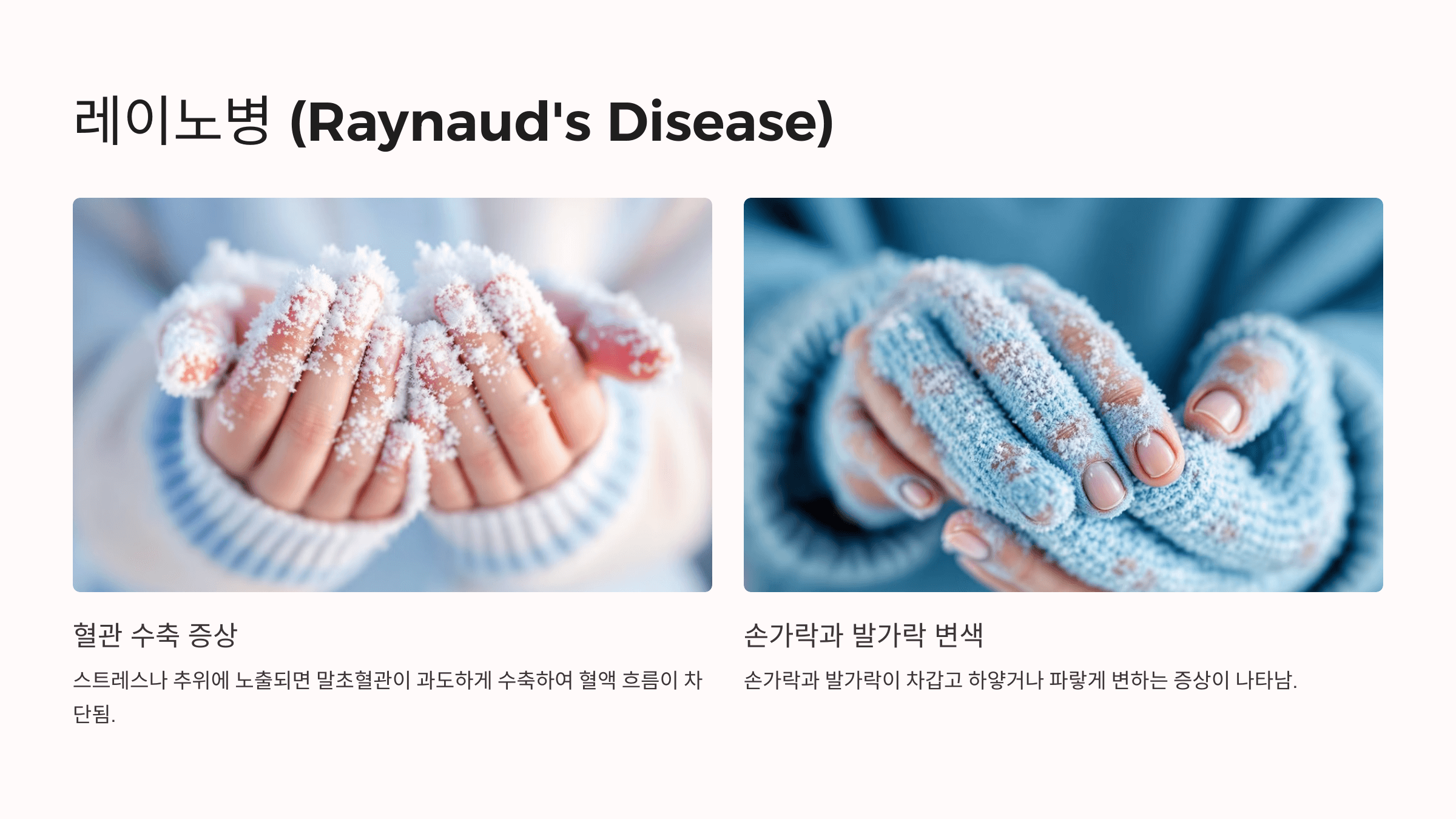 발이 시린 이유와 관련된 사진입니다.